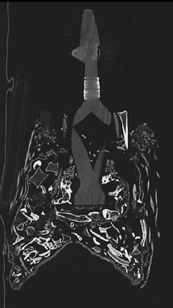 Coupe frontale du panier : on observe un premier sac disposé autour du piètement de la statue et le panier dans lequel repose l’ensemble du dispositif. © Musée du quai Branly - Jacques Chirac